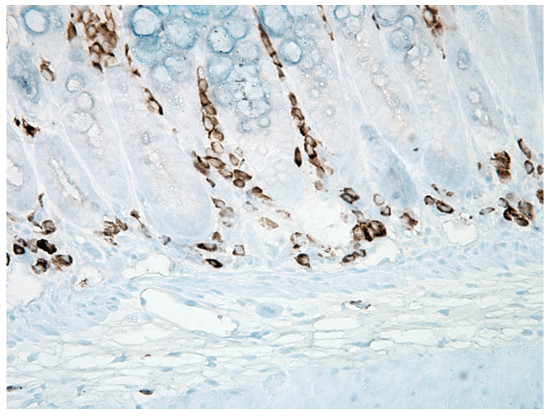 IHC using nitrotyrosine antibodies